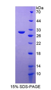 Figure 1. SDS-PAGE