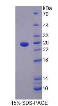 Figure 1. SDS-PAGE