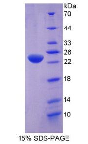Figure 1. SDS-PAGE