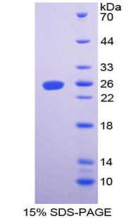 Figure 1. SDS-PAGE