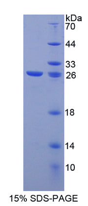 Figure 1. SDS-PAGE