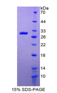 Figure 1. SDS-PAGE