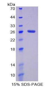 Figure 1. SDS-PAGE