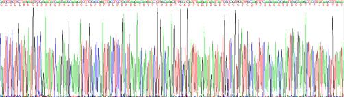 Recombinant Human Protein Kinase R (PKR)