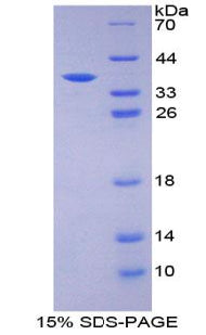 Figure 1. SDS-PAGE