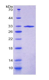 Figure 1. SDS-PAGE
