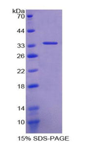 Figure 1. SDS-PAGE