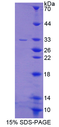 Figure 1. SDS-PAGE