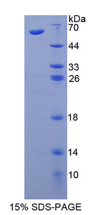 Figure 1. SDS-PAGE