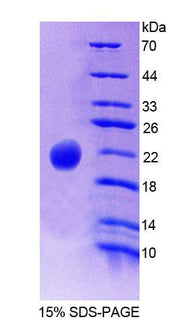 Figure 1. SDS-PAGE
