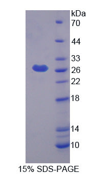 Figure 1. SDS-PAGE