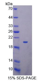 Figure 1. SDS-PAGE