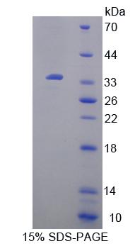 Figure 1. SDS-PAGE