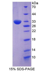 Figure 1. SDS-PAGE