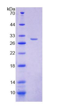 Figure 3. SDS-PAGE