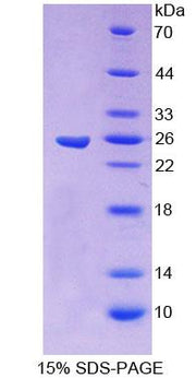 Figure 1. SDS-PAGE
