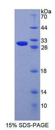 Figure 1. SDS-PAGE