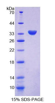 Figure 1. SDS-PAGE