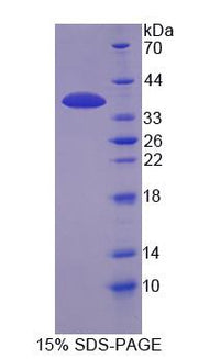 Figure 1. SDS-PAGE