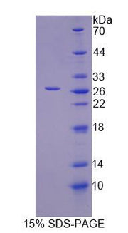 Figure 1. SDS-PAGE