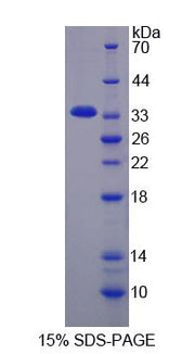 Figure 1. SDS-PAGE