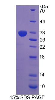 Figure 1. SDS-PAGE