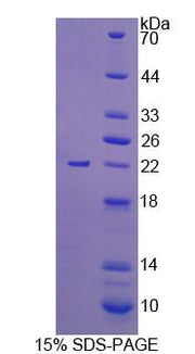 Figure 1. SDS-PAGE