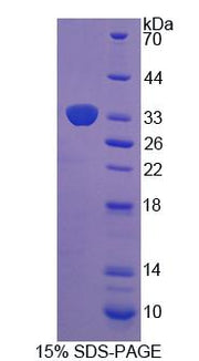 Figure 1. SDS-PAGE