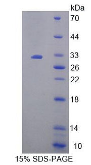 Figure 1. SDS-PAGE