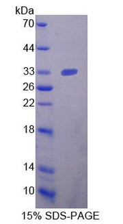Figure 1. SDS-PAGE