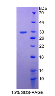 Figure 1. SDS-PAGE