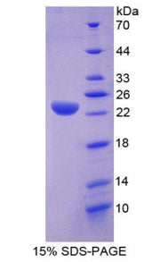Figure 1. SDS-PAGE