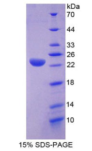 Figure 1. SDS-PAGE