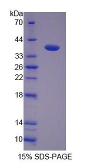 Figure 1. SDS-PAGE