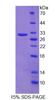 Figure 1. SDS-PAGE