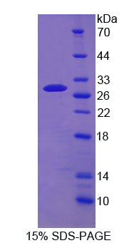 Figure 1. SDS-PAGE