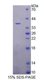 Figure 1. SDS-PAGE