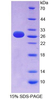 Figure 1. SDS-PAGE