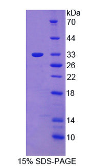 Figure 1. SDS-PAGE