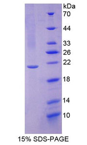 Figure 1. SDS-PAGE