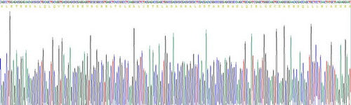Recombinant Human Lamin B1 (LMNB1)