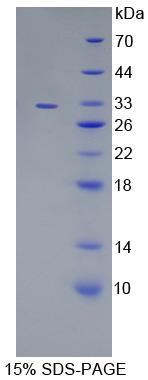 Figure 1. SDS-PAGE