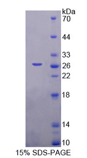 Figure 1. SDS-PAGE