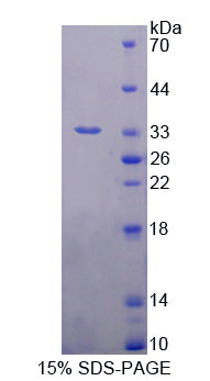 Figure 1. SDS-PAGE