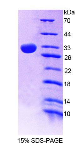 Figure 1. SDS-PAGE