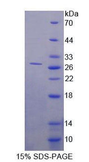 Figure 1. SDS-PAGE