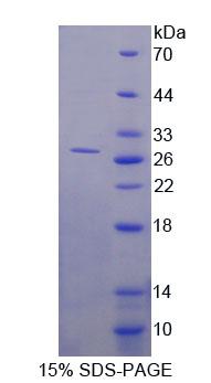 Figure 1. SDS-PAGE
