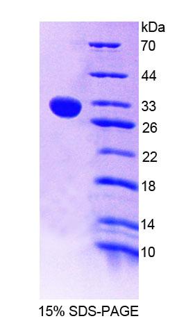 Figure 1. SDS-PAGE
