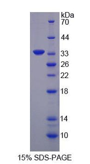 Figure 1. SDS-PAGE