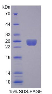 Figure 1. SDS-PAGE